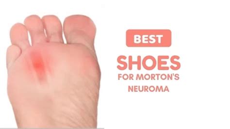 slippers for morton's neuroma relief